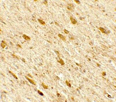 Immunohistochemistry DENR Antibody - BSA Free