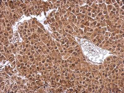 Immunohistochemistry-Paraffin: DENR Antibody [NBP2-16148] - Immunohistochemical analysis of paraffin-embedded HBL435 xenograft, using antibody at 1:500 dilution.