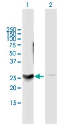 Western Blot: DENR Antibody [H00008562-B01P] - Analysis of DENR expression in transfected 293T cell line by DENR polyclonal antibody.  Lane 1: DENR transfected lysate(21.78 KDa). Lane 2: Non-transfected lysate.