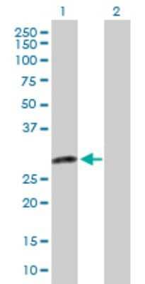 Western Blot: DENR Antibody [H00008562-D01P] - Analysis of DENR expression in transfected 293T cell line by DENR polyclonal antibody.Lane 1: DENR transfected lysate(22.10 KDa).Lane 2: Non-transfected lysate.