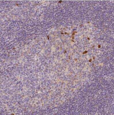 Immunohistochemistry-Paraffin: DEP-1/CD148 Antibody [NBP1-86547] - Staining of human tonsil shows strong cytoplasmic positivity in subset of germinal center cells.