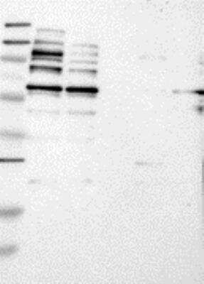 Western Blot: DEPDC1A Antibody [26630002] - Samples: Lane 1, Marker [kDa]: 250, 130, 95, 72, 55, 36, 28, 17, 11  Lane 2, RT-4  Lane 3, U-251MG sp  Lane 4, Human Plasma  Lane 5, Liver  Lane 6, Tonsil , Target weight [kDa]:  89, 61, 41, 31 (splice variants)  Validation score: 2  Validation description:  Supportive - Band of predicted size in kDa (+/-20%) with additional bands present.