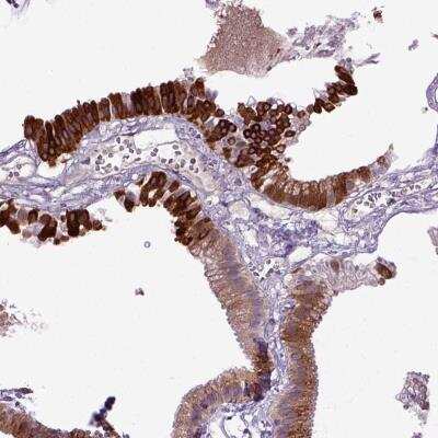 Immunohistochemistry-Paraffin DEPDC1B Antibody