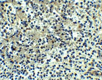 Immunohistochemistry-Paraffin DEPDC1B Antibody - BSA Free