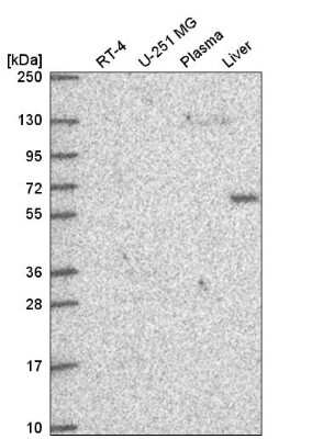 Western Blot DEPDC1B Antibody