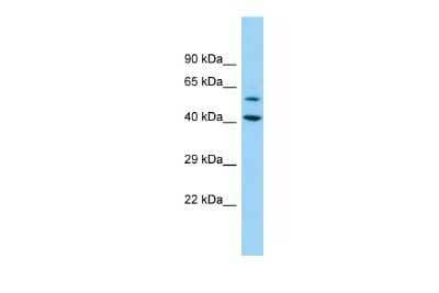 Western Blot: DEPDC1B Antibody [NBP2-84777] - Host: Rabbit. Target Name: DEPDC1B. Sample Type: 293T Whole Cell lysates. Antibody Dilution: 1.0ug/ml