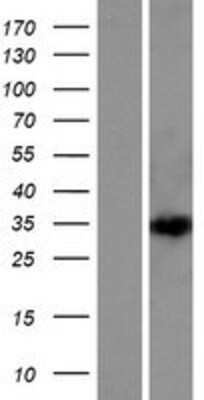 Western Blot DEPDC4 Overexpression Lysate