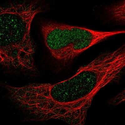 Immunocytochemistry/ Immunofluorescence DERA Antibody