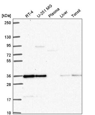 Western Blot DERA Antibody