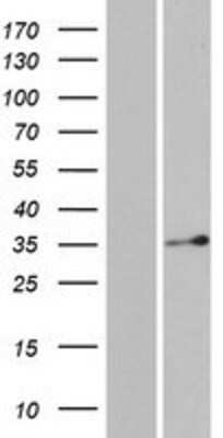 Western Blot: DERA Overexpression Lysate (Adult Normal) [NBP2-07110] Left-Empty vector transfected control cell lysate (HEK293 cell lysate); Right -Over-expression Lysate for DERA.