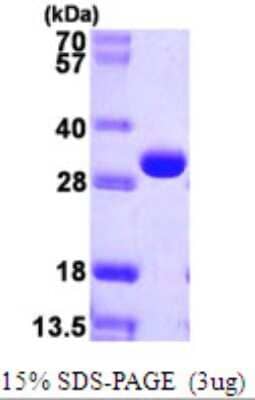 SDS-Page: DERA Protein [NBP2-22649]