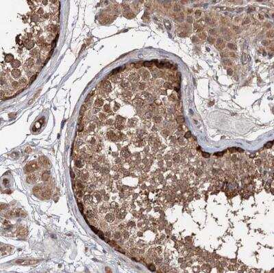 Immunohistochemistry-Paraffin: DEXI Antibody [NBP1-81015] - Staining of human testis shows moderate to strong cytoplasmic positivity in cells in seminiferous ducts.
