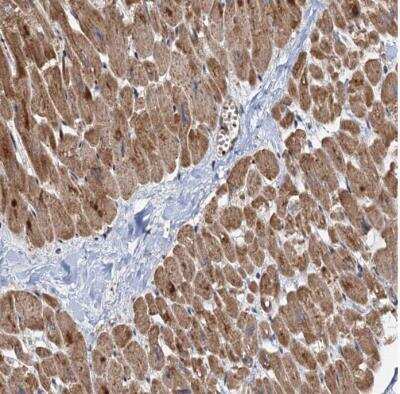 Immunohistochemistry-Paraffin: DEXI Antibody [NBP1-81015] - Staining of human heart muscle shows moderate to strong cytoplasmic positivity in cardiomyocytes.