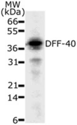 Western Blot: DFF40/CAD Antibody (36A349) - Azide and BSA Free [NBP2-80696] - analysis of 30 ug of HeLa cell lysate with this antibody. Image from the standard format of this antibody.