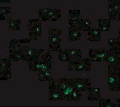 Immunocytochemistry/Immunofluorescence: DFF40/CAD Antibody [NBP1-76884] - Immunofluorescence of DFF40 in Jurkat cells with DFF40 antibody at 20 ug/mL.