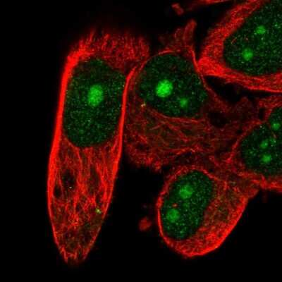 Immunocytochemistry/Immunofluorescence: DFF40/CAD Antibody [NBP2-55648] - Staining of human cell line PC-3 shows localization to nucleus & nucleoli.