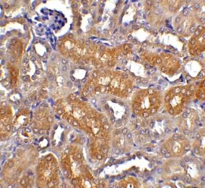 Immunohistochemistry-Paraffin: DFF40/CAD Antibody [NBP1-77009] - Staining of CAD in mouse kidney tissue with CAD antibody at 5 ug/ml.