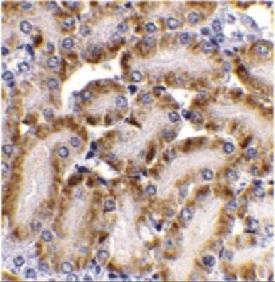 Immunohistochemistry-Paraffin: DFF40/CAD Antibody [NBP1-77009] - Immunohistochemistry of CAD in mouse kidney tissue with CAD antibody at 2 ug/mL.