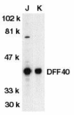 Western Blot: DFF40/CAD Antibody [NBP1-76884] - Jurkat (J) and K562 (K) whole cell lysate with DFF40 antibody at 1:500 dilution.