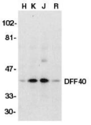 Western Blot: DFF40/CAD Antibody [NBP1-76948] - Analysis of DFF40/CAD in HeLa (H), K562 (K), Jurkat (J), and Raji (R) whole cell lysate with anti-DFF40/CAD (I18) using NBP1-76948 at 1:500 dilution.