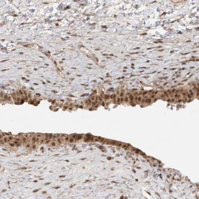 Immunohistochemistry-Paraffin: DFF45/ICAD Antibody [NBP1-85248] - Staining of human urinary bladder shows nuclear and cytoplasmic positivity in urothelial cells.