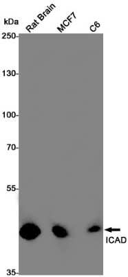 Western Blot: DFF45/ICAD Antibody (S09-4J6) [NBP3-15022] - Western blot detection of DFF45/ICAD in Rat Brain, MCF7, C6 cell lysates using DFF45/ICAD Rabbit mAb (1:1000 diluted). Predicted band size: 37KDa. Observed band size: 45KDa.