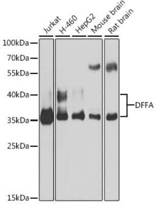 Western Blot: DFF45/ICAD Antibody [NBP3-03452] - Western blot analysis of extracts of various cell lines, using DFF45/ICAD antibody (NBP3-03452) at 1:1000 dilution. Secondary antibody: HRP Goat Anti-Rabbit IgG (H+L) at 1:10000 dilution. Lysates/proteins: 25ug per lane. Blocking buffer: 3% nonfat dry milk in TBST. Detection: ECL Basic Kit. Exposure time: 15s.