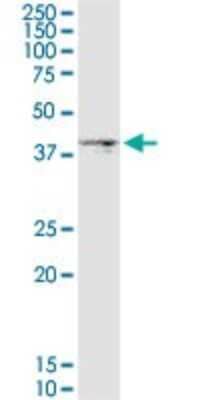 Western Blot: DGAT2 Antibody (4C1) [H00084649-M03] - Analysis of DGAT2 expression in MCF-7.