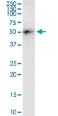 Western Blot: DGAT2 Antibody (4C1) [H00084649-M03] - Analysis of DGAT2 expression in human stomach.