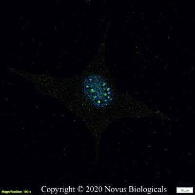 Immunocytochemistry/Immunofluorescence: DGAT2 Antibody [NBP3-05769] - NIH3T3 cells were fixed in 4% paraformaldehyde for 10 minutes and permeabilized in 0.05% Triton X-100 in PBS for 5 minutes. The cells were incubated with anti-DGAT2 Antibody NBP3-05769 at 5 ug/ml overnight at 4C and detected with an anti-rabbit Dylight 488 (Green) at a 1:1000 dilution for 60 minutes. Nuclei were counterstained with DAPI (Blue).  Cells were imaged using a 100X objective and digitally deconvolved.