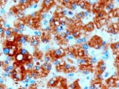 Immunohistochemistry-Paraffin: DGAT2 Antibody [NB100-57851] - Analysis of DGAT2 in Human Liver. Antibody at 3 ug/mL. Microwaved antigen retrieval with Tris/EDTA buffer pH 9, HRP-staining.