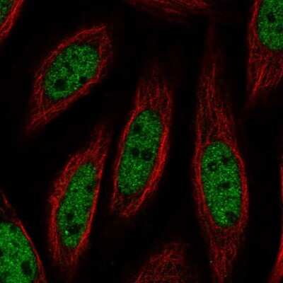 Immunocytochemistry/Immunofluorescence: DGCR2 Antibody [NBP2-56538] - Staining of human cell line SiHa shows localization to nucleoplasm & nuclear bodies.