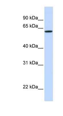 Western Blot: DGCR2 Antibody [NBP1-59220] - Hela cell lysate, concentration 0.2-1 ug/ml.