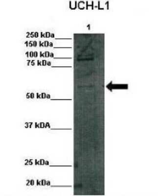 Western Blot: DGCR2 Antibody [NBP1-59220] - Lanes: Lane 1: 75,000 rat INS1 cells Primary Antibody Dilution: 1:1000 Secondary Antibody: Anti rabbit-HRP Secondary Antibody Dilution: 1:1000 Gene Name: DGCR2 Submitted by: Benedich Bracleva, VUB, Universitair Ziekenhuis Brussel