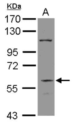 Western Blot DGCR2 Antibody