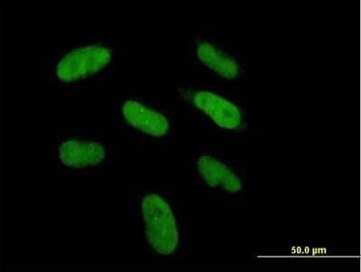 Immunocytochemistry/ Immunofluorescence DGCR6 Antibody