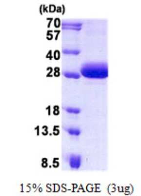 SDS-Page: DGCR6 Protein [NBP2-23002]