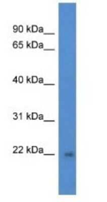 Western Blot DGCR6L Antibody - BSA Free