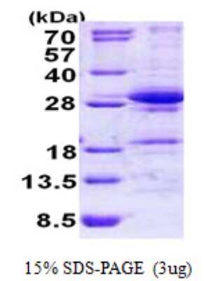 SDS-PAGE Recombinant Human DGCR6L His Protein