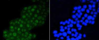 Immunocytochemistry/Immunofluorescence: DGCR8 Antibody (ST04-79) [NBP2-67506] - Staining DGCR8 in PC12 cells (green). The nuclear counter stain is DAPI (blue). Cells were fixed in paraformaldehyde, permeabilised with 0.25% Triton X100/PBS.