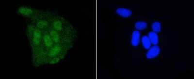 Immunocytochemistry/Immunofluorescence: DGCR8 Antibody (ST04-79) [NBP2-67506] - Staining DGCR8 in Hela cells (green). The nuclear counter stain is DAPI (blue). Cells were fixed in paraformaldehyde, permeabilised with 0.25% Triton X100/PBS.