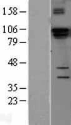 Western Blot: DGCR8 Overexpression Lysate (Adult Normal) [NBL1-09850] Left-Empty vector transfected control cell lysate (HEK293 cell lysate); Right -Over-expression Lysate for DGCR8.