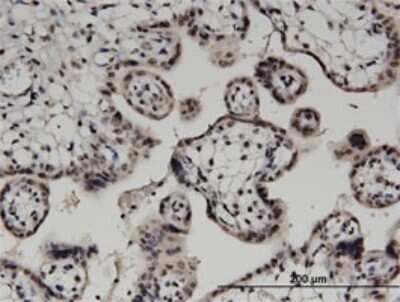 Immunohistochemistry-Paraffin: DGK-alpha Antibody (2B7) [H00001606-M02] - Analysis of monoclonal antibody to DGKA on formalin-fixed paraffin-embedded human placenta. Antibody concentration 3 ug/ml.