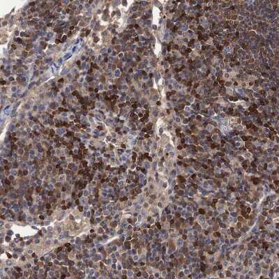 Immunohistochemistry-Paraffin: DGK-alpha Antibody [NBP2-13916] - Staining of human lymph node shows strong membranous positivity in lymphocytes.