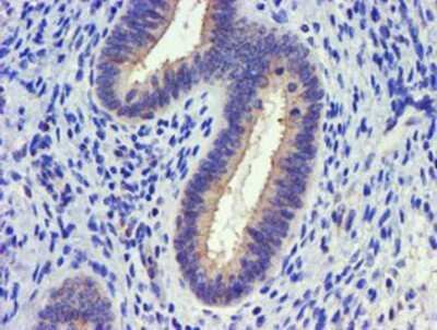 Immunohistochemistry: DGK-alpha Antibody (OTI4A11) - Azide and BSA Free [NBP2-70547] - Staining of paraffin-embedded Human endometrium tissue using anti-DGKA mouse monoclonal antibody.