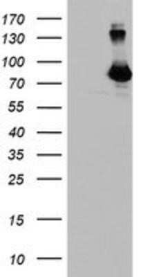 Western Blot: DGK-alpha Antibody (OTI4A11) - Azide and BSA Free [NBP2-70547] - HEK293T cells were transfected with the pCMV6-ENTRY control (Left lane) or pCMV6-ENTRY DGKA (Right lane) cDNA for 48 hrs and lysed. Equivalent amounts of cell lysates (5 ug per lane) were separated by SDS-PAGE and immunoblotted with anti-DGKA.