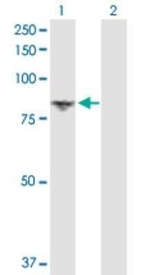 Western Blot: DGK-alpha Antibody [H00001606-D01P] - Analysis of DGKA expression in transfected 293T cell line by DGKA polyclonal antibody.Lane 1: DGKA transfected lysate(82.60 KDa).Lane 2: Non-transfected lysate.