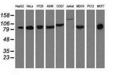 Western Blot: DGK-beta Antibody (OTI1F9) - Azide and BSA Free [NBP2-70552] - Analysis of extracts (35ug) from 9 different cell lines by using anti-DGKB monoclonal antibody.