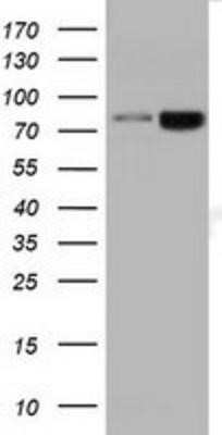 Western Blot: DGK-beta Antibody (OTI1F9) - Azide and BSA Free [NBP2-70552] - HEK293T cells were transfected with the pCMV6-ENTRY control (Left lane) or pCMV6-ENTRY DGKB (Right lane) cDNA for 48 hrs and lysed. Equivalent amounts of cell lysates (5 ug per lane) were separated by SDS-PAGE and immunoblotted with anti-DGKB.