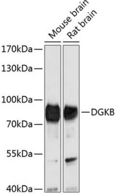 Western Blot: DGK-beta Antibody [NBP2-92028] - Analysis of extracts of various cell lines, using DGK-beta at 1:1000 dilution.Secondary antibody: HRP Goat Anti-Rabbit IgG (H+L) at 1:10000 dilution.Lysates/proteins: 25ug per lane.Blocking buffer: 3% nonfat dry milk in TBST.Detection: ECL Basic Kit .Exposure time: 10s.